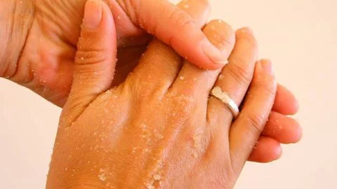Dry skin: Causes and symptoms