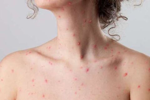 Dry skin: Causes and symptoms
